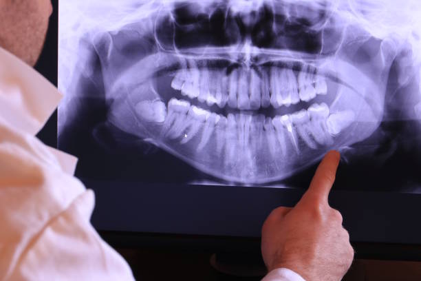 Best Emergency Dental Extractions in Chualar, CA