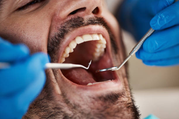 Best Broken or Cracked Tooth Emergency Dentist in Chualar, CA