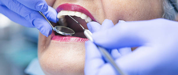 Best Emergency Dentist for Lost Fillings or Crowns in Chualar, CA